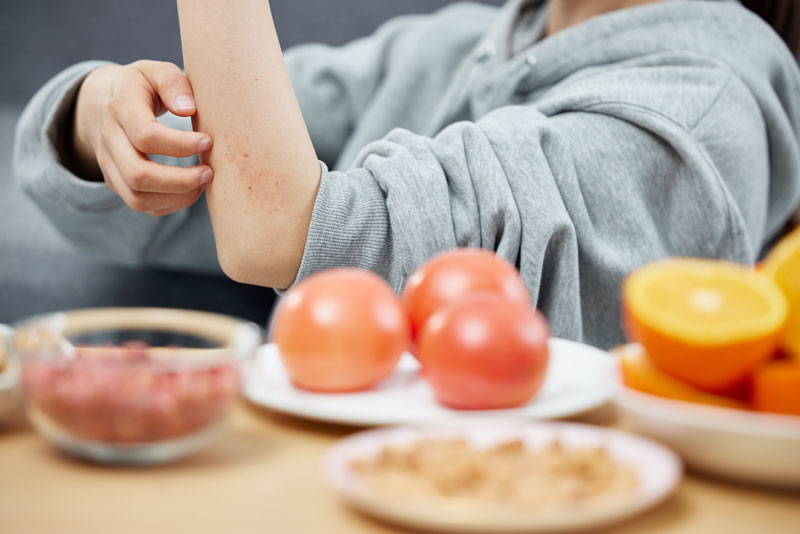 摄图网_502356330_女性食物过敏抓挠特写（企业商用）.jpg