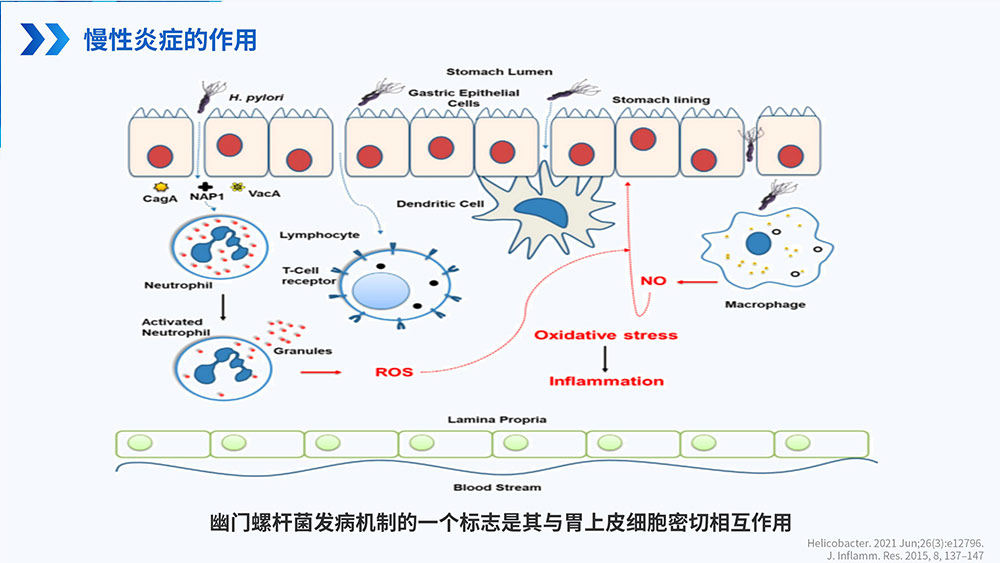 幽门螺旋杆菌感染_59.jpg